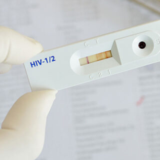 Hiv Test Kit